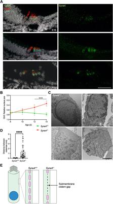 A Nesprin-4/kinesin-1 cargo model for nuclear positioning in cochlear outer hair cells